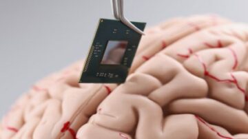 Unternehmen für Gehirnimplantate schließen sich zusammen, um eine neue Industriegruppe zu gründen