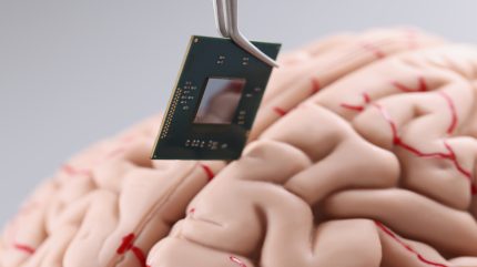 Brain implant companies unite to launch new industry group