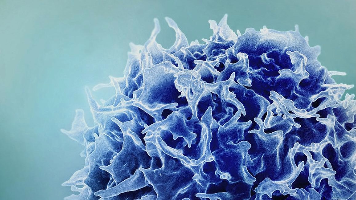 Cellterapi tar sikte på dödliga hjärntumörer i två kliniska prövningar
