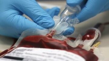 Cerus anuncia resultados positivos en ensayo de purificación de sangre