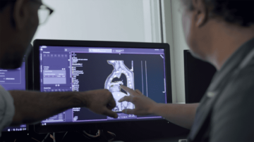 Soluções inteligentes agilizam o planejamento do tratamento de radioterapia – Physics World