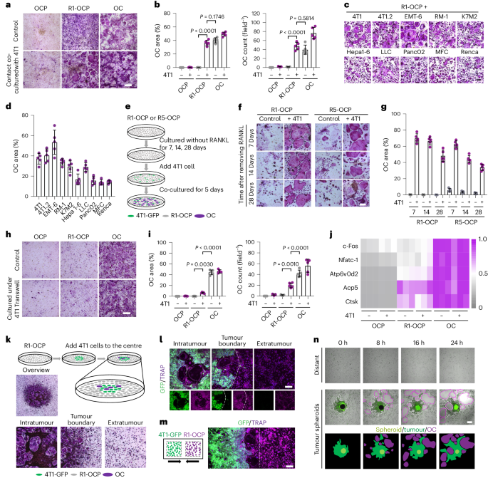Targeting initial tumour–osteoclast spatiotemporal interaction to prevent bone metastasis - Nature Nanotechnology