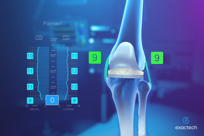 Powered by Active Intelligence®, Exactech's Newton Knee technique works in concert with ExactechGPS® to provide orthopaedic surgeons with dynamic soft tissue analytics, pre-resection operative insights and full-range personalized planning designed to simplify, evaluate and execute balanced total knee replacement surgery.