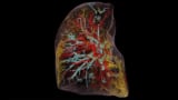 3D-Bild einer menschlichen Lunge