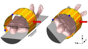 Radiation-transparent RF coil designed for MR guidance of particle therapy – Physics World