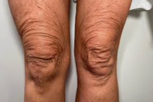 The Best Tips To Help Your Knees Look Better